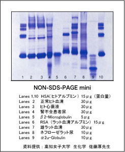 NON-SDS-PAGE img
